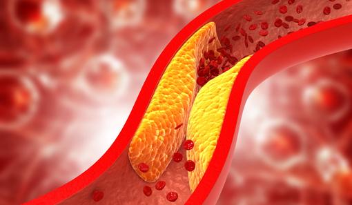 vérzsírok, lipidek